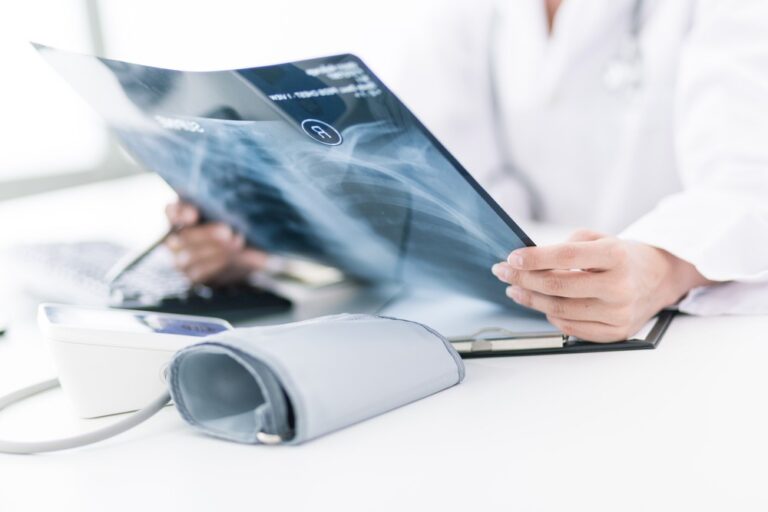 How to Treat Chest Pain from Airbag Deployment AICA