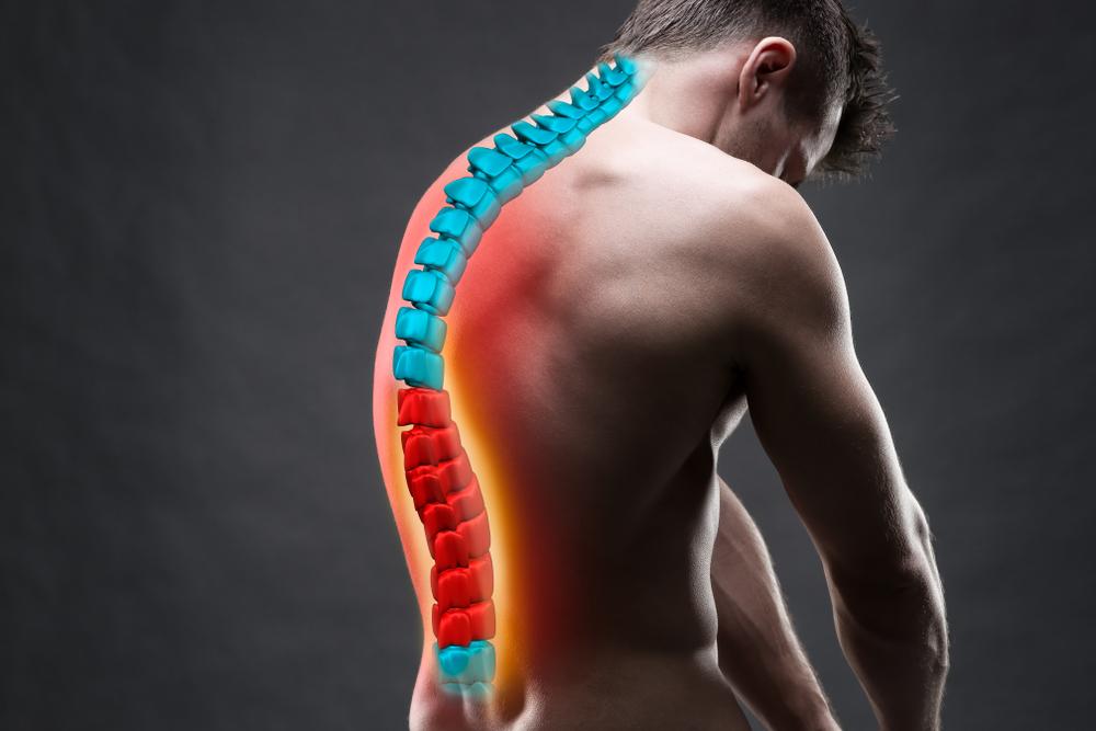 What Causes Herniated Discs? - Senara Chiropractic & Med Spa